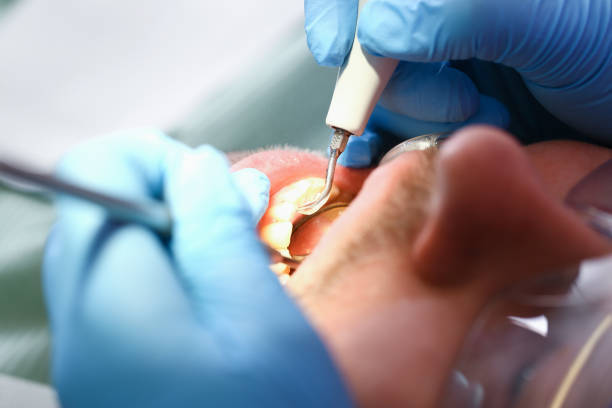 Best Walk-In Emergency Dentist in Oakhurst, OK