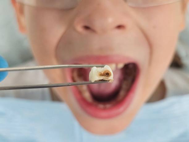 Best Walk-In Emergency Dentist in Oakhurst, OK