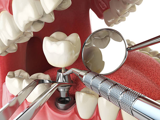 Best Emergency Broken Tooth Repair in Oakhurst, OK